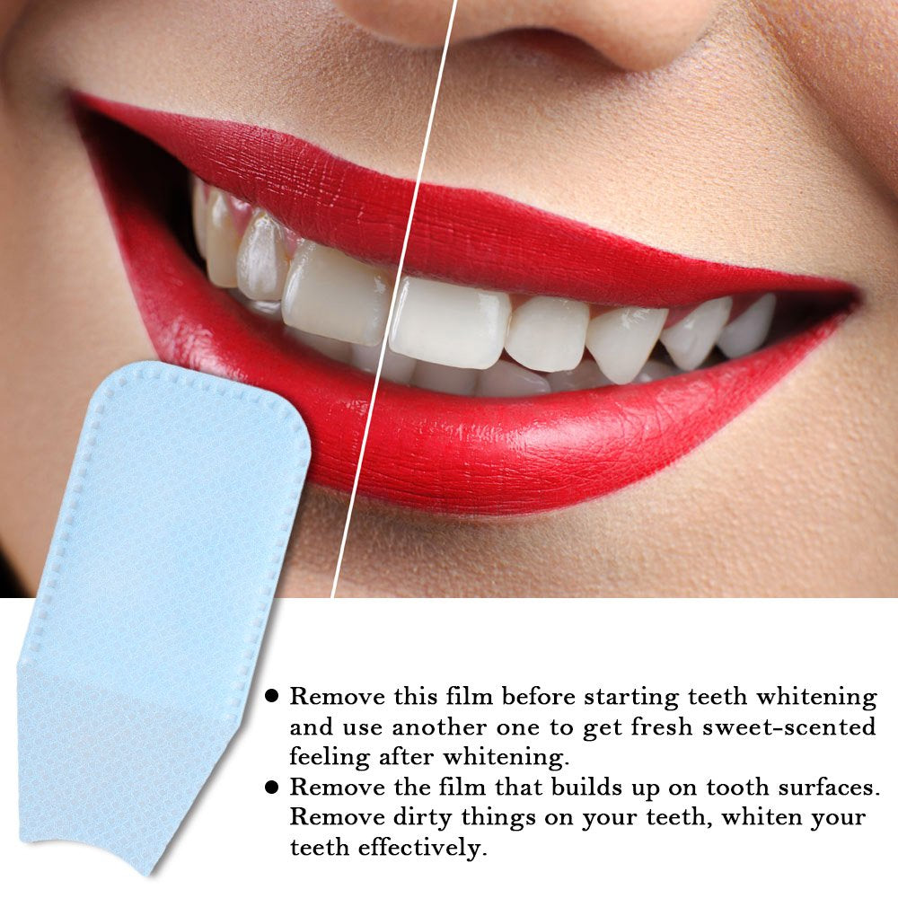 Mint-Flavored Oral Finger Wipes Teeth Whitening Wipes Oral Cleaning Wipe (100 Pcs)